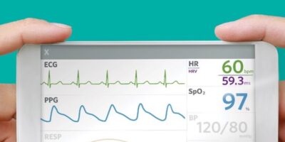 Biosensor module integrates PPG and ECG for mobile use